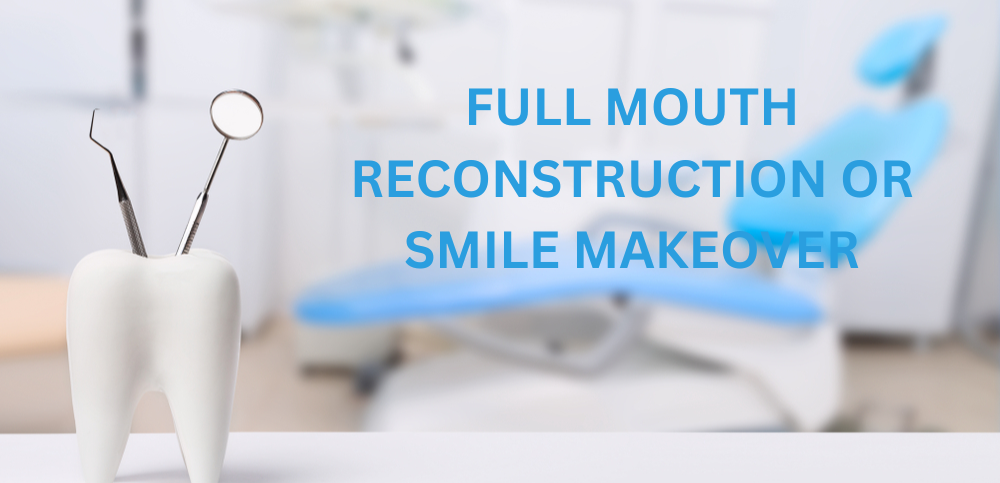Full mouth rehabilitation